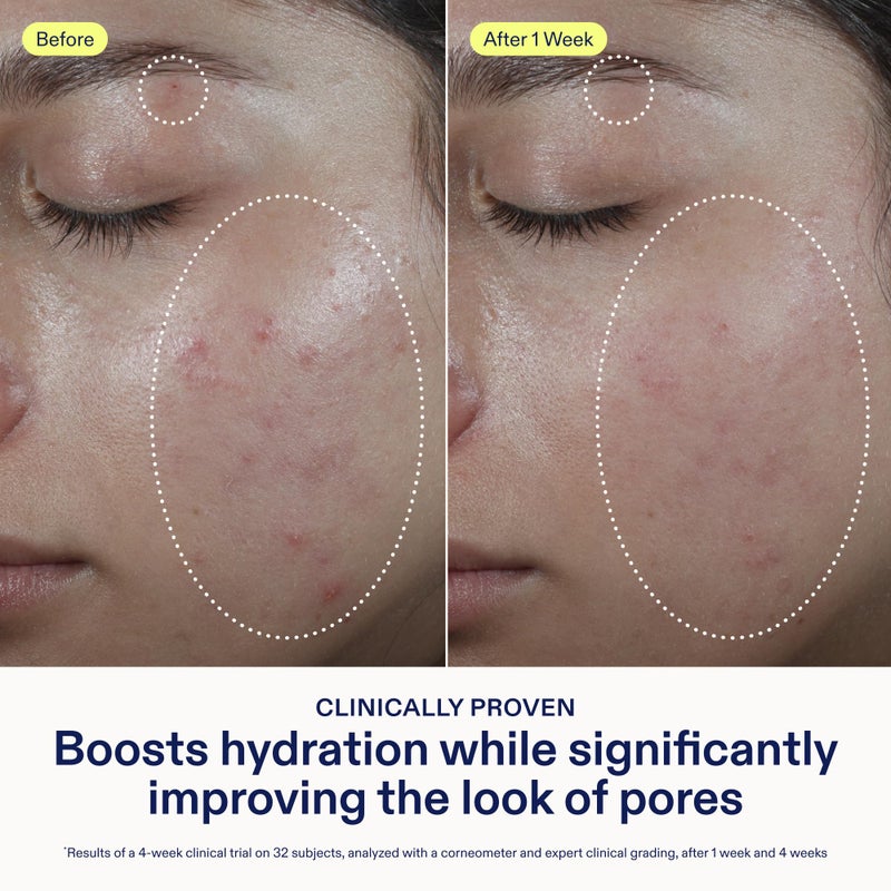 Skinfix Barrier Balancing Water Cream - 1.7 oz - Hyaluronic Acid & Niacinamide Water-Based Moisturizer for Face - Combo + Oily Skin - Acne-Safe, Fragrance Free, Vegan, Cruelty Free - Image 3