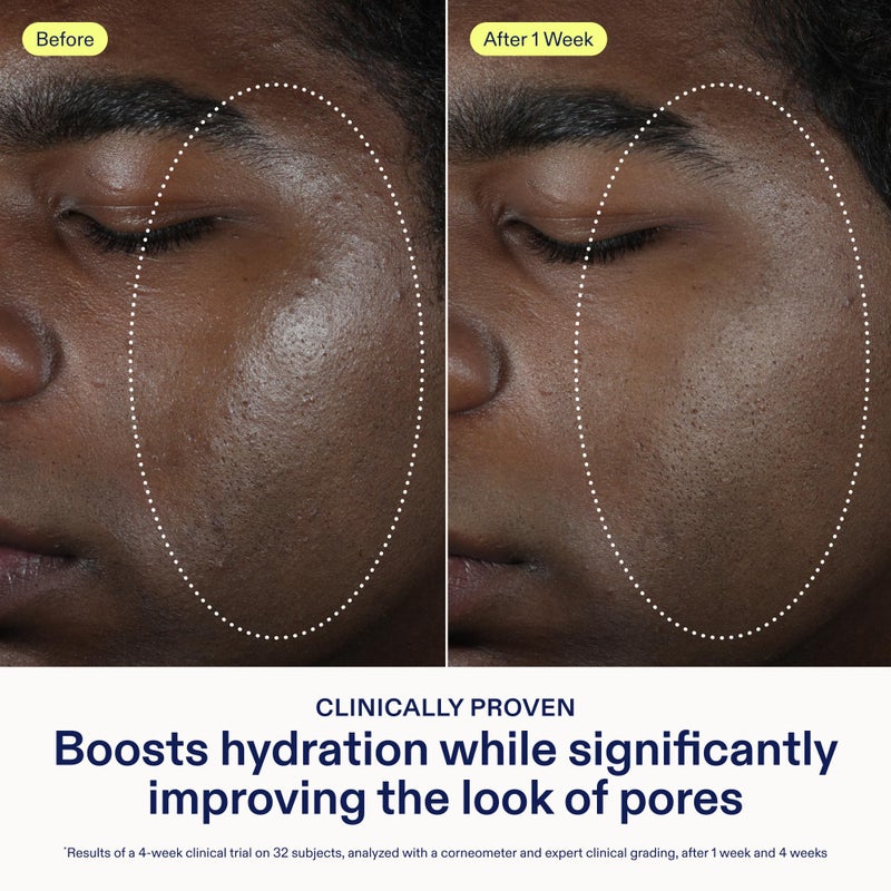 Skinfix Barrier Balancing Water Cream - 1.7 oz - Hyaluronic Acid & Niacinamide Water-Based Moisturizer for Face - Combo + Oily Skin - Acne-Safe, Fragrance Free, Vegan, Cruelty Free - Image 4