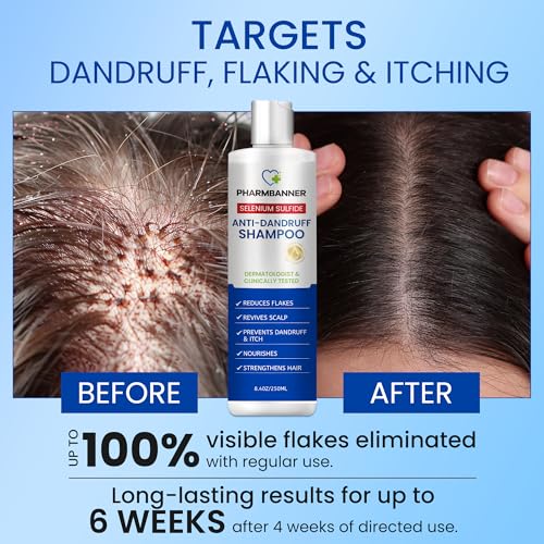 PHARMBANNER Anti-Dandruff Shampoo with Selenium Sulfide: For Flaky Scalp, Itching & Seborrheic Dermatitis Relief - Menthol & Lavender Oil - Moisturizing, Color Safe, Gentle for All Hair Types - 8.4oz - Image 2