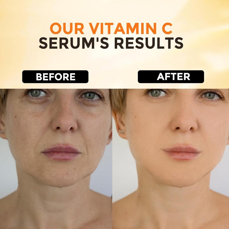 +1HEROLABS Vitamin C Serum for Face Anti Aging Face Eye Serum Hyaluronic Acid Reduce Fine Lines Dark Spots and Wrinkle - Image 4