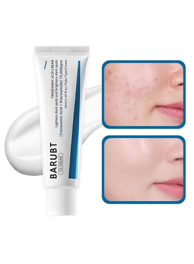 BARUBT TX-CREAM,Tranexamic Acid Cream,Lightens Dark Spots and Brightens Dark Spots,(Tranexamic Acid+ Niacinamide)70,000ppm 50ml - Image 1