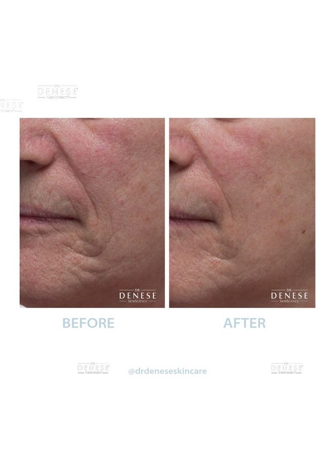 Dr. Denese Collagen Firming Peel Off Mask | 4 Fl Oz | A Unique Aha Based Peel Off Mask Designed To Tighten The Appearance Of The Skin - Image 4
