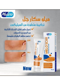 ميلو سكار 30 جم