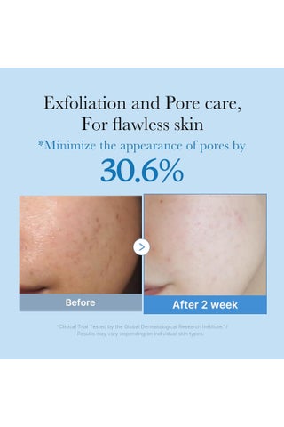 Zero Pore Toner 250ml, Exfoliating & Hydrating Toner with AHA BHA PHA Niacinamide & Panthenol, Pore Tightening Face Toner for Oily Acne Prone Skin, Controls Sebum & Refines Texture - view 3