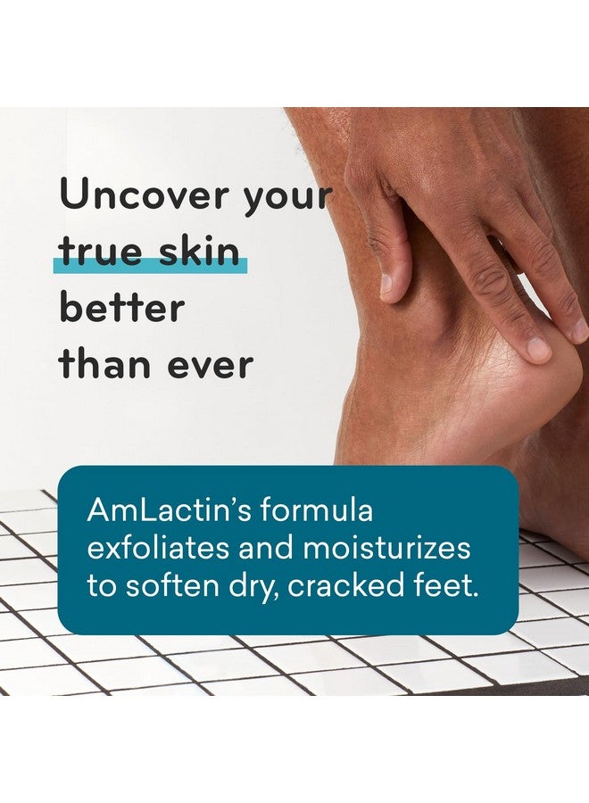 AmLactin Foot Repair Cream - 3 oz Foot Cream for Dry Cracked Heels with 15% Lactic Acid - Exfoliator and Moisturizer for Dry Skin & Foot Care (Packaging May Vary) - Image 3