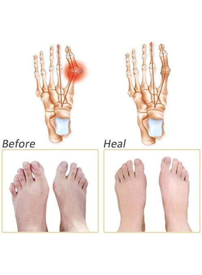 Toe gel splint in a honeycomb shape - Image 2