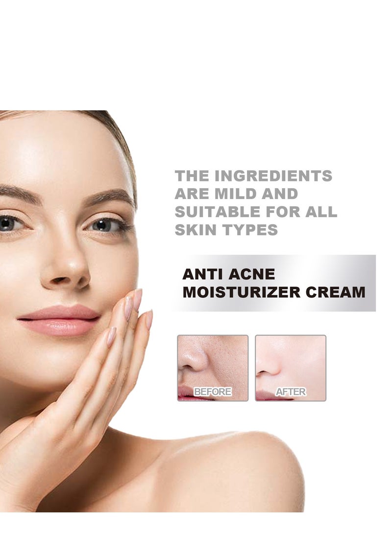 EELHOE Anti-Acne Cream, Face Moisturizer Cream for Acne Prone Skin, Acne Control Facial Cream with Hyaluronic Acid and Niacinamide, Acne Remover Cream for Hydrating, Skin Care for Sensitive Skin 50G - Image 4