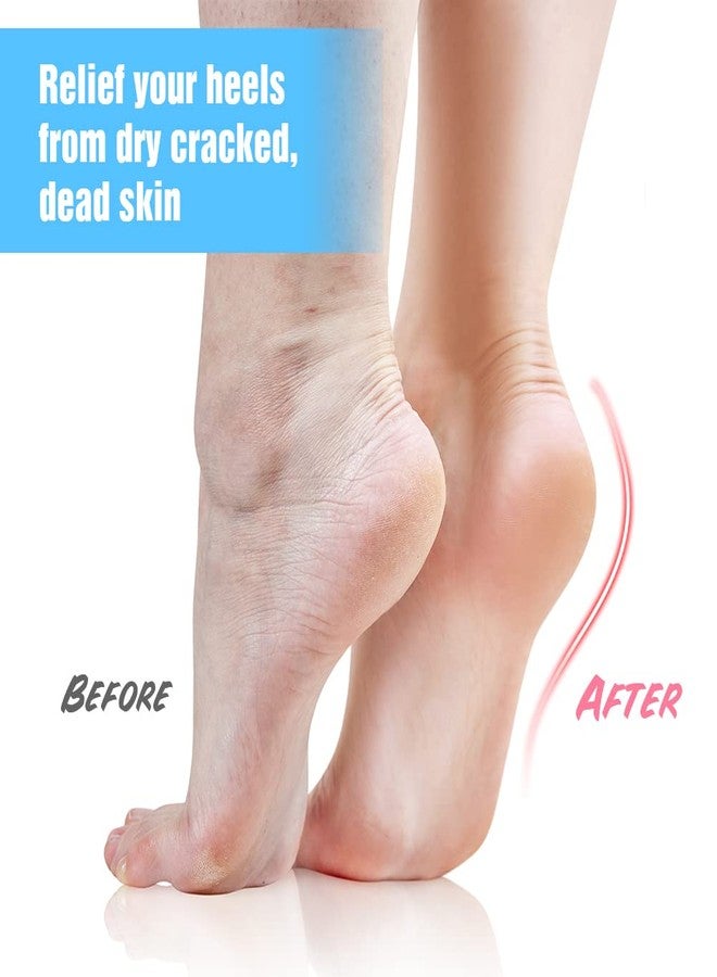 Codream Moisturizing Heel Gel Socks: Heal Dry Cracked Heel Treatment Overnight Pedicure Foot Spa Sock | 2 Pairs Soft Silicone Moisturizer Sleeve to Repair Callus Rough Heel - Image 5