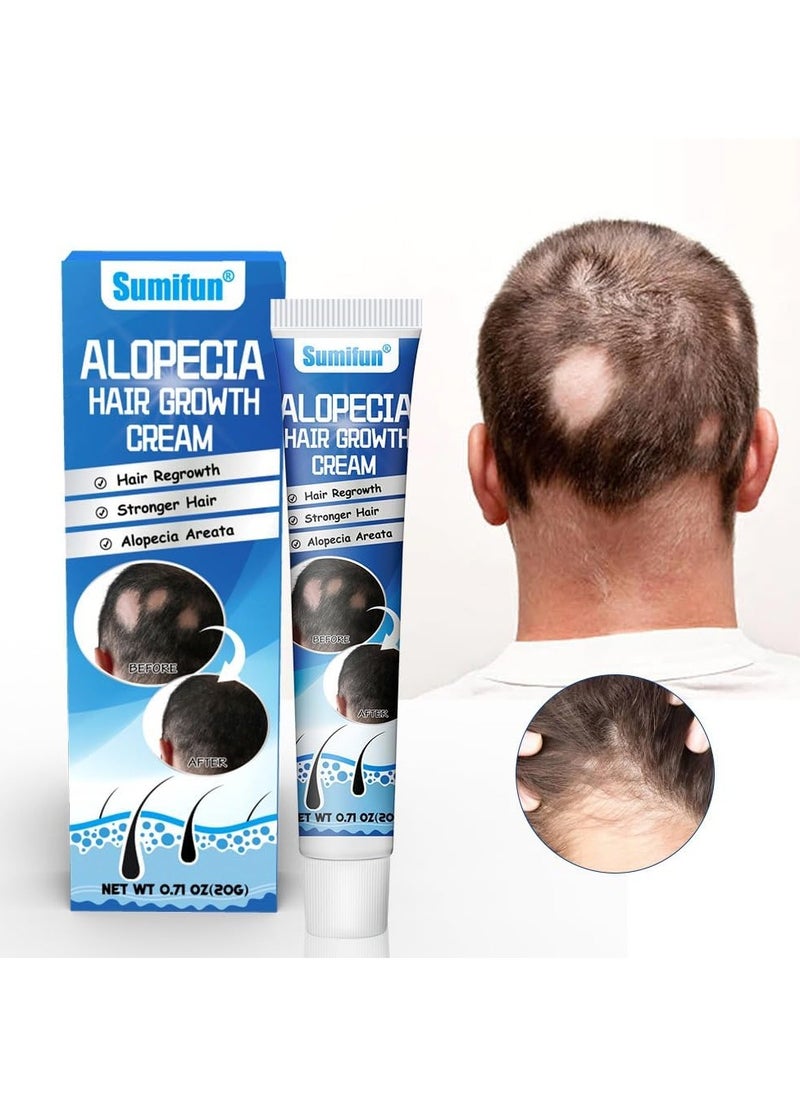Sumifun - Alopecia Hair Growth Cream, 20g - Revitalizing Scalp and Promoting Hair Growth - Effective Treatment for Alopecia & Thinning Hair - Nourishes & Strengthens Hair Follicles - Reduces Hair Loss - Image 1