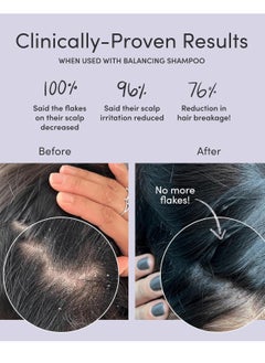 JUPITER Jupiter, Physician-Formulated Scalp Balancing Conditioner for Dry, Itchy, Oily, Flaky Scalp, Sulfate-Free, Natural Fragrance, Vegan, Color-Safe, & Paraben-Free Conditioner for Women & Men  - Image 2