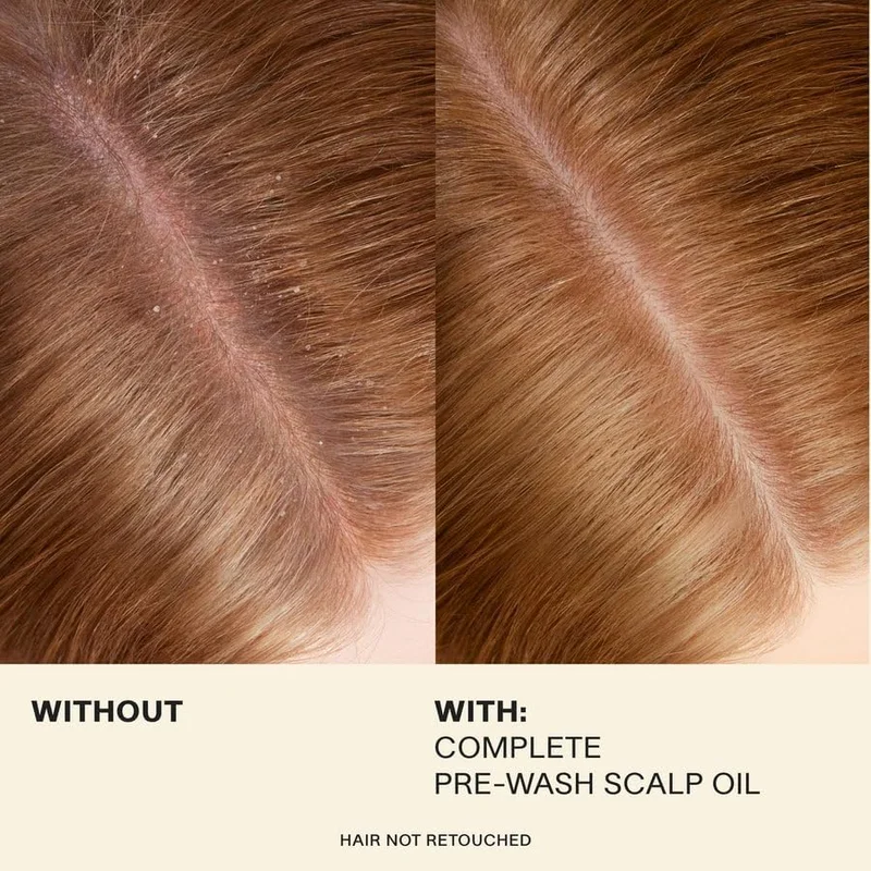 JVN  JVN Complete Pre-Wash Scalp Oil - Nourishing, Hydrating, and Strengthening Treatment for All Hair Types, 5 mL  | Best Price UAE