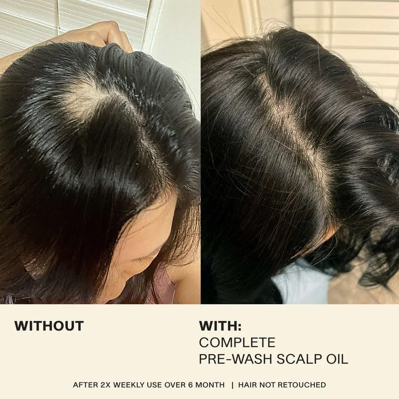 JVN  JVN Complete Pre-Wash Scalp Oil - Nourishing, Hydrating, and Strengthening Treatment for All Hair Types, 5 mL  | Best Price UAE