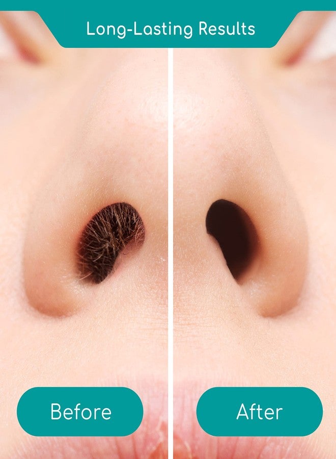 Medi Grade Nose Hair Removal Kit for Men and Women with Reusable Wax Stick, 1.76 oz - Eco-friendly Set for Removing Unsightly, Itchy Nose Hairs Includes Beads, Tape and Bag - Image 3