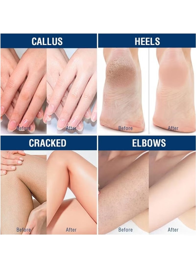 CANAMIN 40% Urea Cream for Cracked Feet & Hands 150g, Urea Cream for Dry Skin Moisturizer Cream, Callus Remover, Foot and Hand Cream Care Lotion Nourishes Repairs & Softens Skin Heels Repair Cream - Image 4