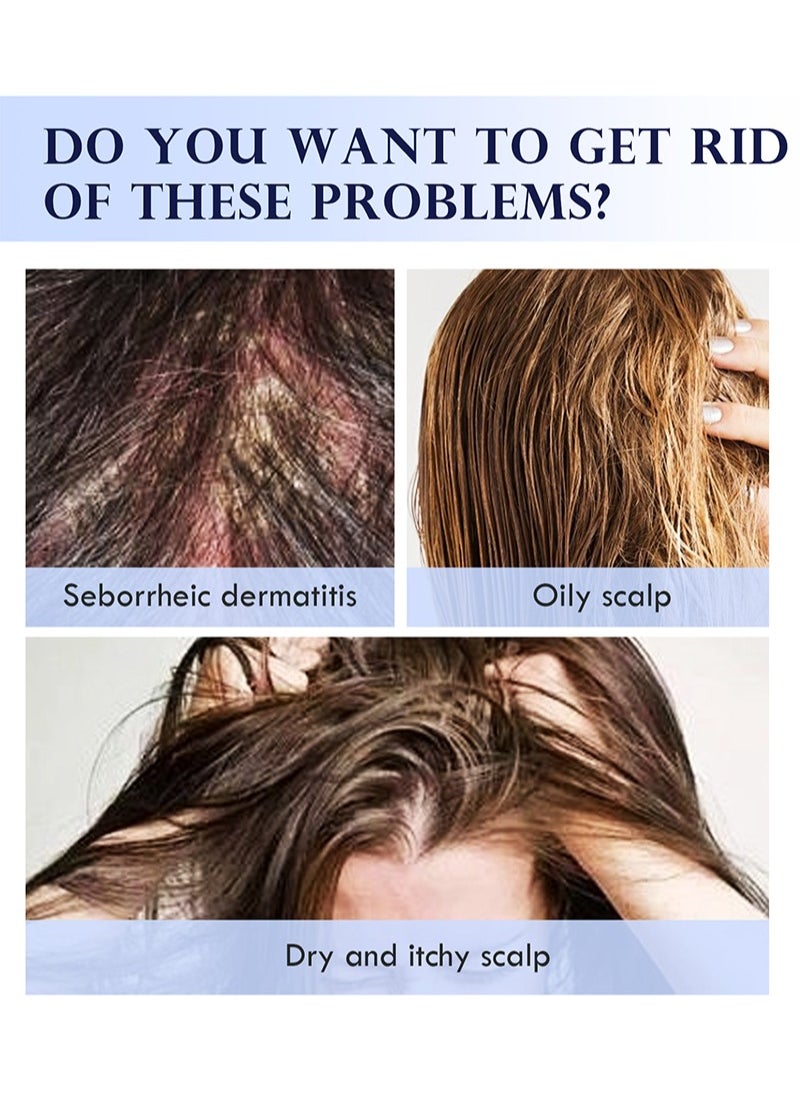 Lanthome - Scalp Serum for Dry and Itchy Scalp - Promote Scalp Health - Clarifying Scalp Scrub for Healthier and Stronger Hair，Hair Regrowth Serum for Thinning Hair, Hair Loss, Frizzy and Damaged Hair - Image 1