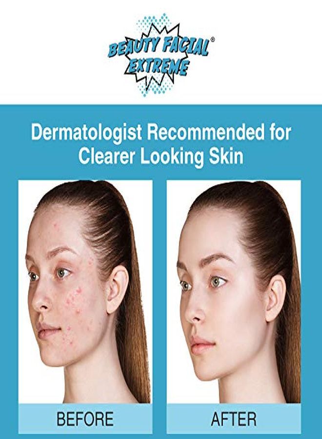 Beauty Facial Extreme Acne Treatment Pads Contains Salicylic, Glycolic, & Lactic Acid For Face & Body. Eliminates Oily Skin, Clogged Pores & Cystic Breakouts. Remover For Dark Spots, Whitehead & Blackhead Pimples.  - Image 3