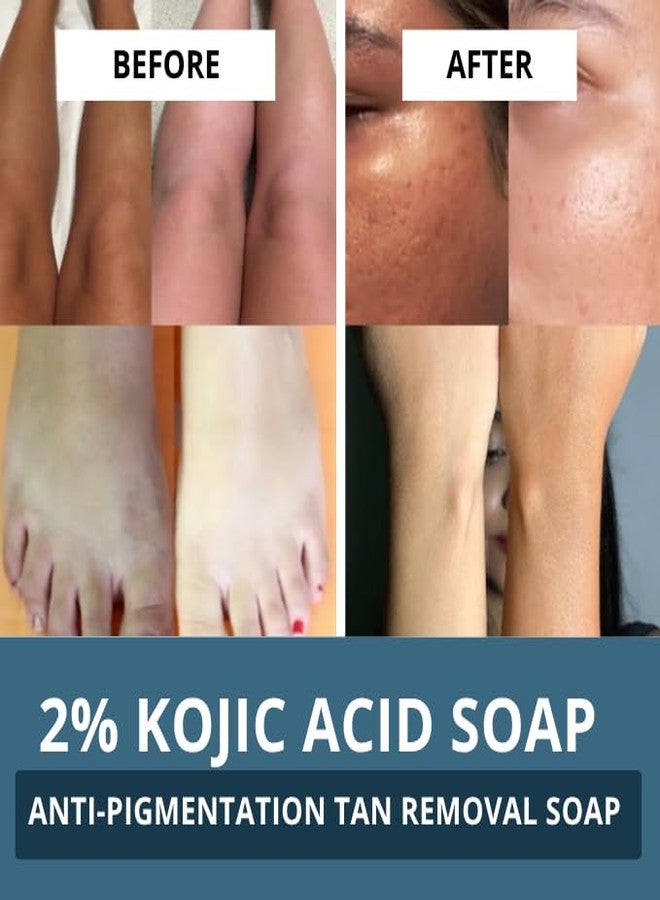 BAKE 2% Kojic Acid Scrub Treatment Soap (100 Gms Pack of 3) with Alpha Arbutin, Lactic Acid & Niacinamide | For Pigmentation, Dark Spots, Tan Removal, Brightens Underarms | Soap for Women & Men | 100g x 3 - Image 3