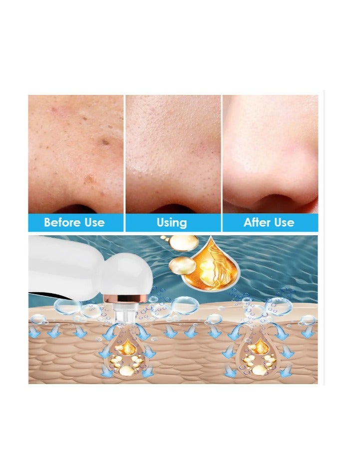Generic Small Bubble Skin Beautifier Facial Blackhead Remover Vacuum, Facial Pore Cleaner Device with 6 Removable Suction Head for Women and Men  - Image 5