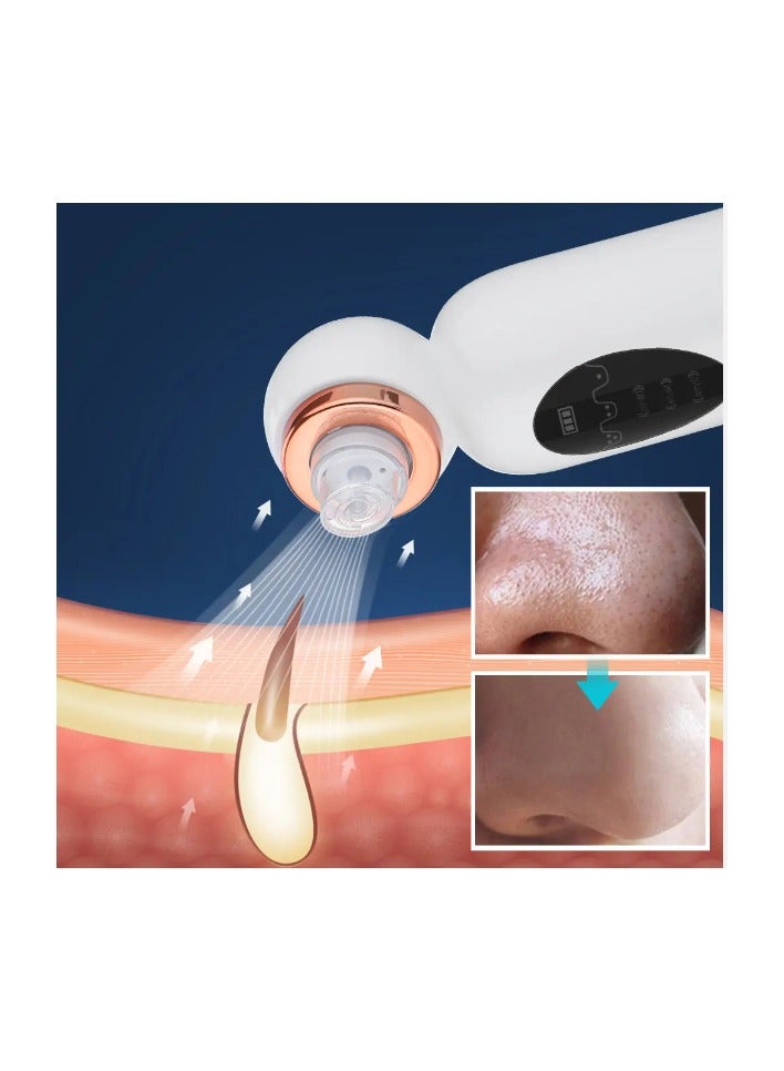 Generic Small Bubble Skin Beautifier Facial Blackhead Remover Vacuum, Facial Pore Cleaner Device with 6 Removable Suction Head for Women and Men  - Image 4