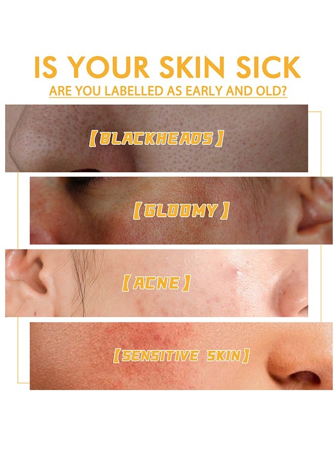 EELHOE Honey Tearing Mask, Honey Mask, Oil Control Blackhead Remover Honey Tearing Peel Mask Off Dead Skin Clean Pores Peel Mask Dead Skin - Image 4