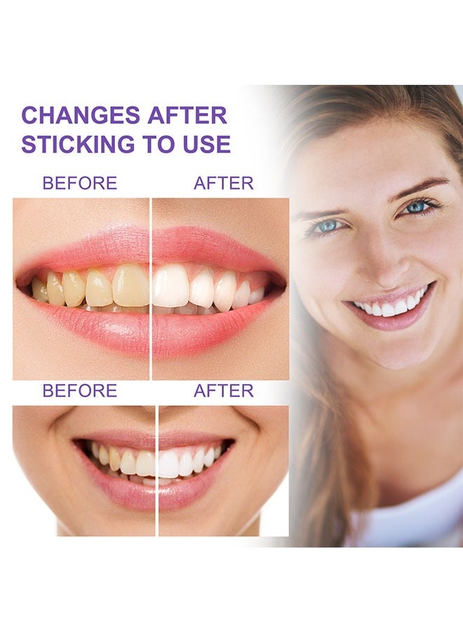 إيلهو جهاز تقويم الأسنان الأرجواني 30ml ، تبييض الأسنان ، وإزالة الجير و رائحة الفم ، وإزالة القهوة والشاي والأصفر الأسنان ، وتنظيف مشرق الأرجواني معجون الأسنان - Image 4