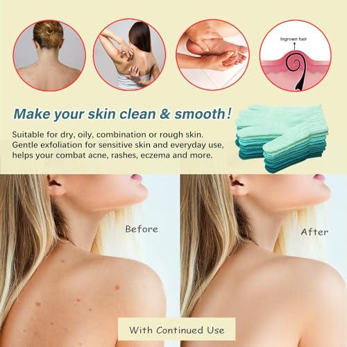 MIG4U Shower Exfoliating Scrub Gloves Medium to Heavy Bathing Gloves Body Wash Dead Skin Removal Deep Cleansing Sponge Loofah for Women and Men 5 Pairs 5 Colors - Image 5