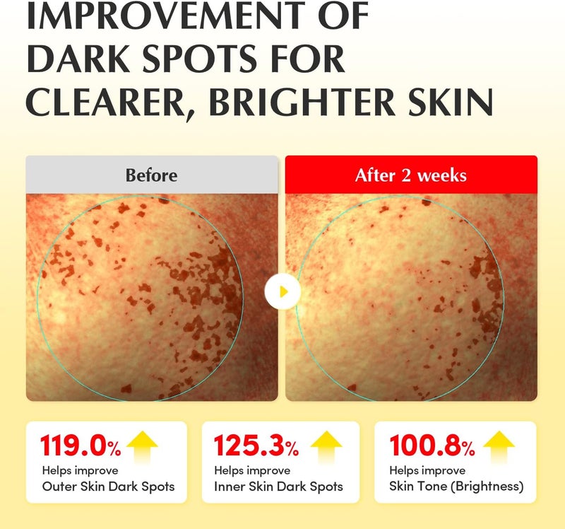 eqqualberry تونر إكوالبيري الفيتاميني المضيء - فيتامين سي ونياسيناميد 3% | تقشير يومي لطيف | ترطيب تحضيري للبشرة المتألقة | 150 مل - Image 4