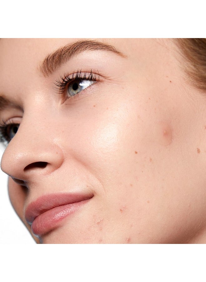 PEACE OUT - PEACE OUT Skincare Acne Day Dot. 6-hour Fast Acting Sheer Hydrocolloid Pimple Patches with Salicylic Acid, Ultra-Thin, Virtually Invisible, Quickly Clear Breakouts, Blemishes and Zits, 20 dots - Image 1