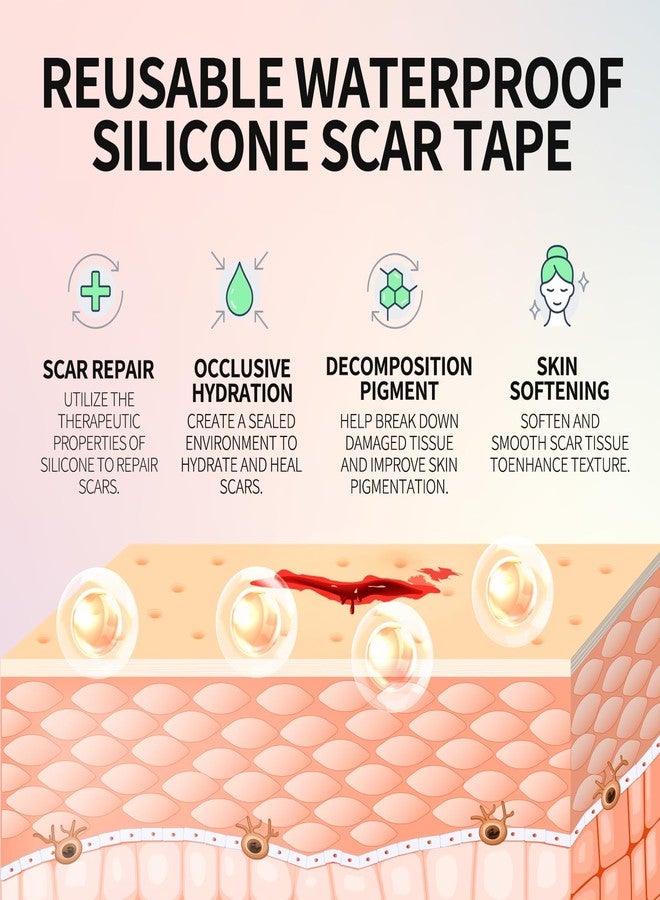 Zvtq Medical Silicone Scar Sheets,Silicone scar tape- Reusable Scar Tape for C-Section Surgery Keloids & Burns 4cm x 1.5m (1.6" x 60" (Clear - Image 3