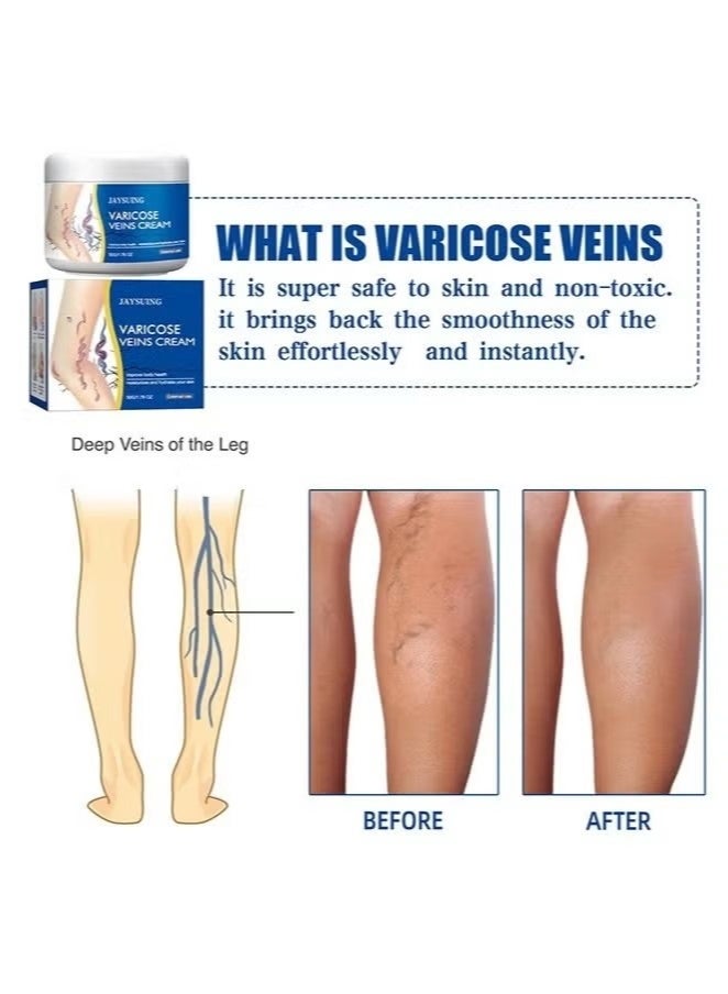 Jaysuing Varicose Veins Care Cream | Improves Leg Blood Circulation & Relieves Heaviness | For Spider Veins | 50G - Image 2