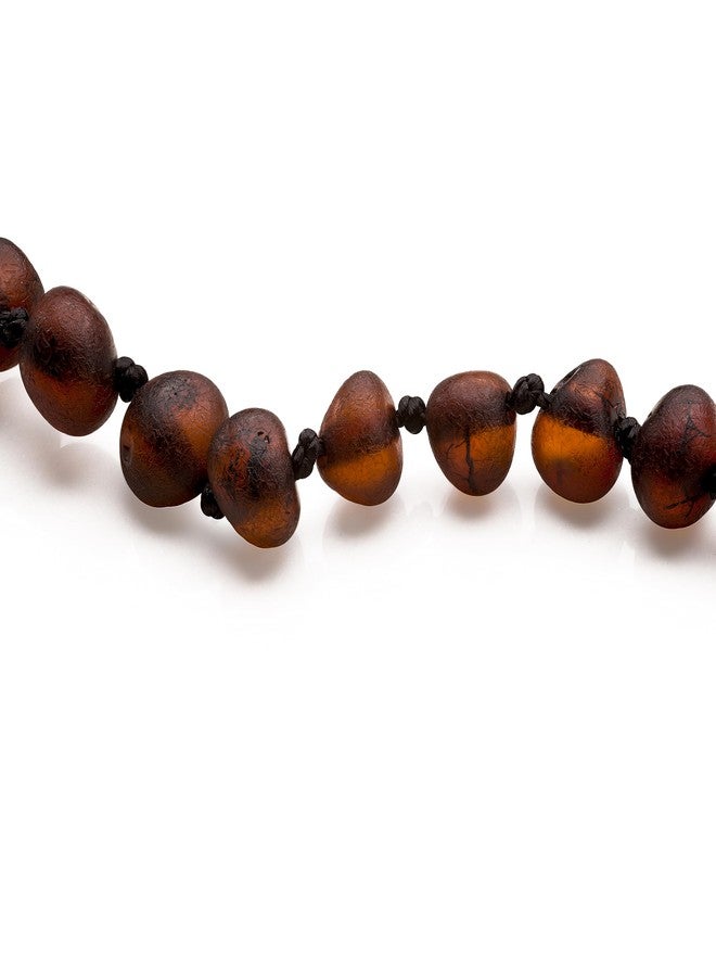 Baltic Proud Amber Necklace and Bracelet Gift Set (Unisex Cherry Raw 12.5 Inches/5.5 Inches) - Certified Premium Quality Raw Baltic Sea Amber - Image 2