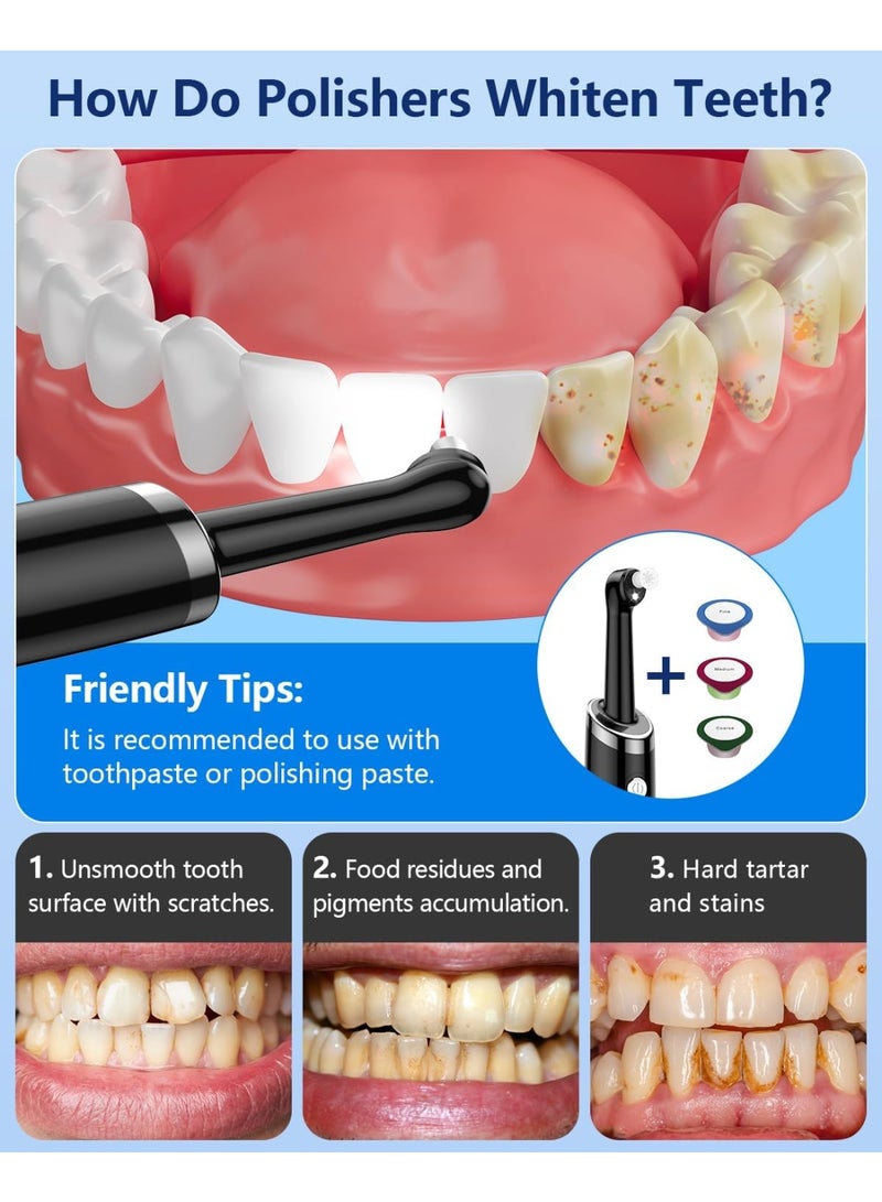 AirYoung مجموعة تلميع الأسنان القابلة لإعادة الشحن للتنظيف اليومي والتبييض والتلميع، تلميع أسنان كهربائي مع ضوء LED، 5 رؤوس فرشاة، 5 أوضاع سرعة، مقاوم للماء - Image 2