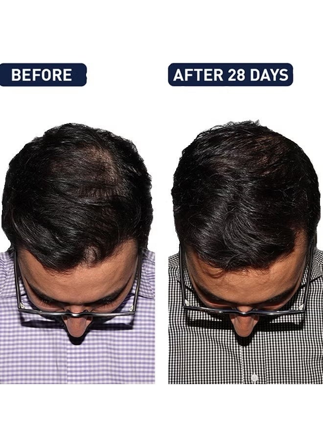 FEG Hair Growth Spray Regrowth 50ml - Image 4