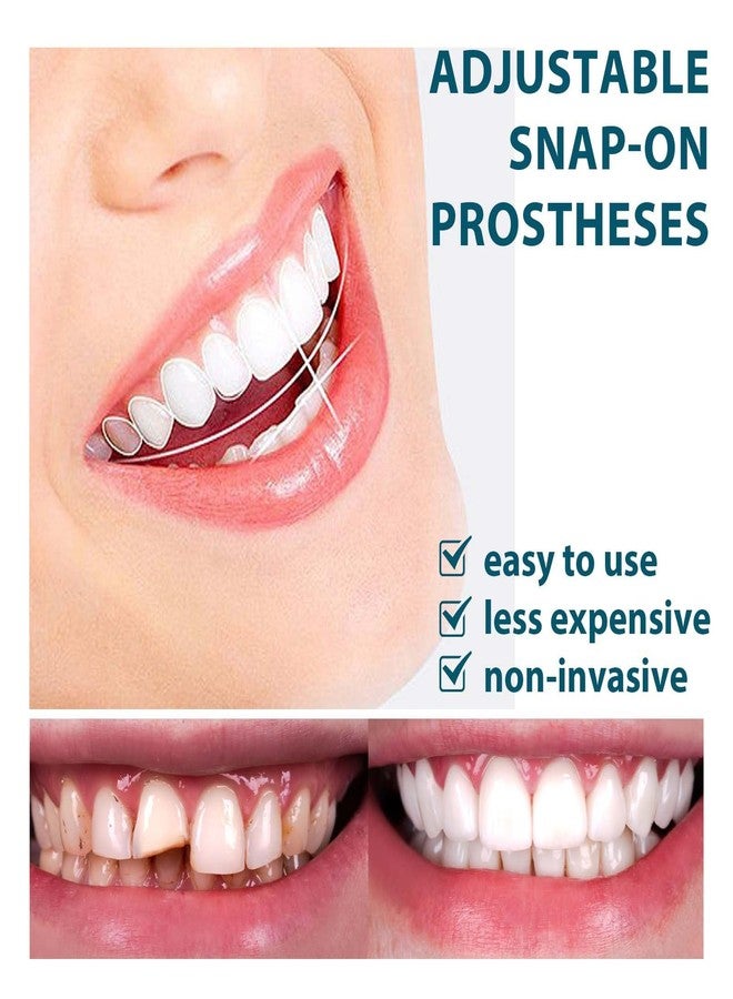 DAONPHARI Adjustable Snap On Denture Modification Teeth, Gap Filling Braces, Correction Teeth, Denture Kit | Customizable Fit | Comfortable & Lightweight | Reusable & Easy Maintenance - Image 4