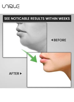 Unique 3PCS Jaw Exerciser for Men & Women, 3 Resistance Levels Silicone Jaw Toner for Beginner, Intermediate & Advanced Users, Jawline Exerciser & Jawline Shaper  (White/Grey/Black)  - Image 4