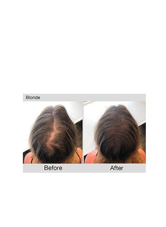Joan Rivers Beauty - Joan Rivers Great Hair Day Root Touch Up Powder Duo - Root Cover Up Hair Powder for Thicker, Fuller Looking Hair - Fill-In Powder for Thinning Hair and Gray Hair Coverage (Blonde) - Image 1