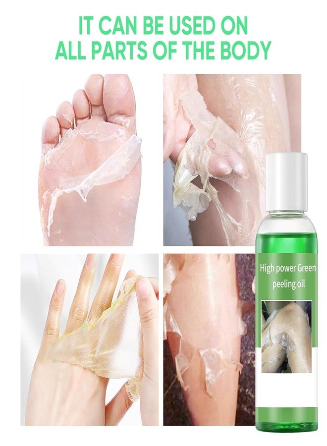 YAFUSIPE Peeling Oil for Dark Skin Green Peeling Oil Solution Extra Strength Exfoliate Body Extra Strong Exfoliating Peels for Hand Feet Dark Knuckle Knee Elbow Chemical Peel Body for All Skin Type 3.38 FLOZ - Image 2