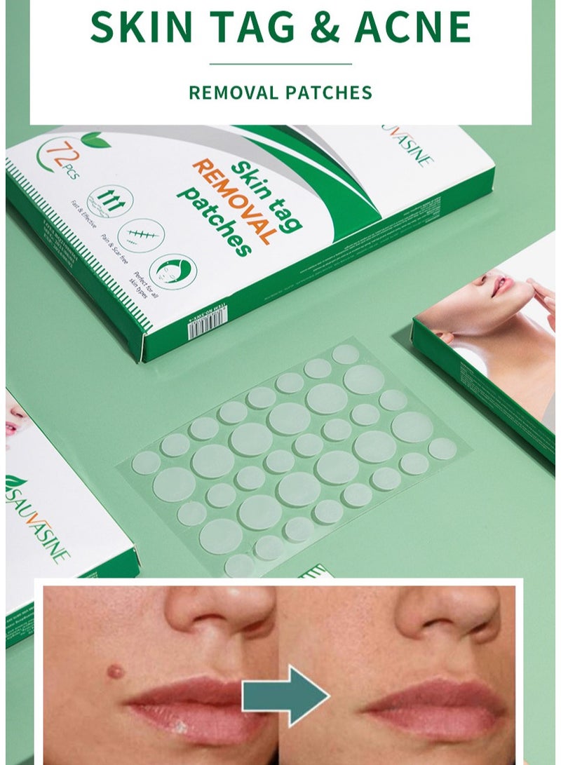 SAUVASINE 72-Piece Wart Removal Patch For Skin Mole Cleaning And Care Suitable For Corns, Thorns, Warts, Granules, Sharp Warts, Filaments  - Image 2