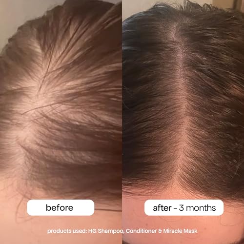 BONDIBOOST HG Anti-Thinning Shampoo for Women & Men [16.90 fl oz], Clinically Tested to Promote Fuller + Thicker-Looking Hair, Natural Mint Scent + Procapil, Redensyl & Rosemary Formula, Sulfate-Free - Image 4
