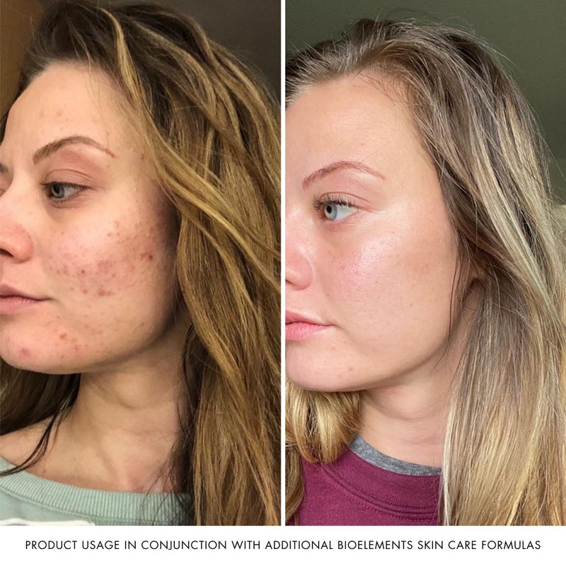 Bioelements RayDefense - 4 fl oz - Hydrating Broad-Spectrum SPF 30 Sunscreen & Moisturizer for All Skin Types - Vegan, Gluten Free - Never Tested on Animals - Image 5