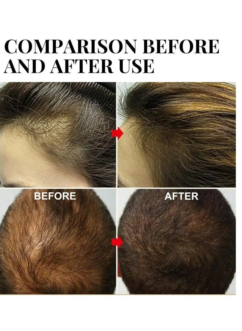 AS SEEN ON TV - Batana Oil For Hair Growth, Natural And Safe Nourishing Hair Care Oil,  Moisturizing Batana Oil Butter For Hair Loss Treatments, Organic Hair Growth Essence For All Hair Types, (D 20ml) - Image 1