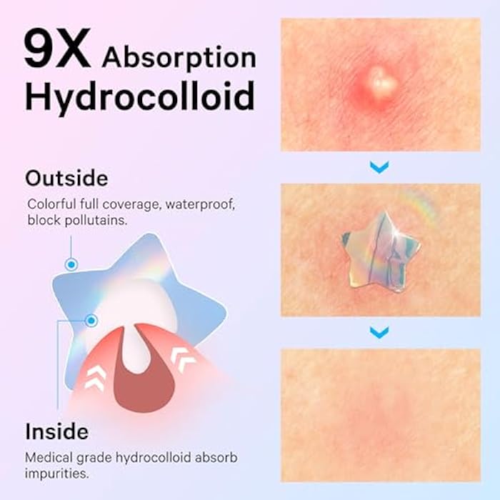 Sosky Hologram Pimple Patches for Face, Hydrocolloid Acne Patches with Salicylic Acid, Cute Star Zit Stickers,Colorful Blemish Covers,144 Count Blue Pink Star Heart Moon Cloud Butterfly Flower - Image 3