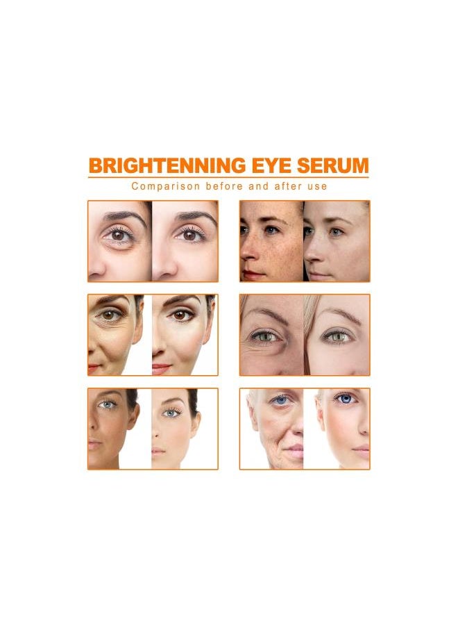 Generic - SADOER Turmeric Anti-Oxidation Face Serum, Turmeric Anti Oxidation Face Serum, Turmeric Antioxidant Face Serum, Turmeric Dark Spot Corrector Serum, Turmeric Oil Serum for Improve Skin Tone (B) - Image 1