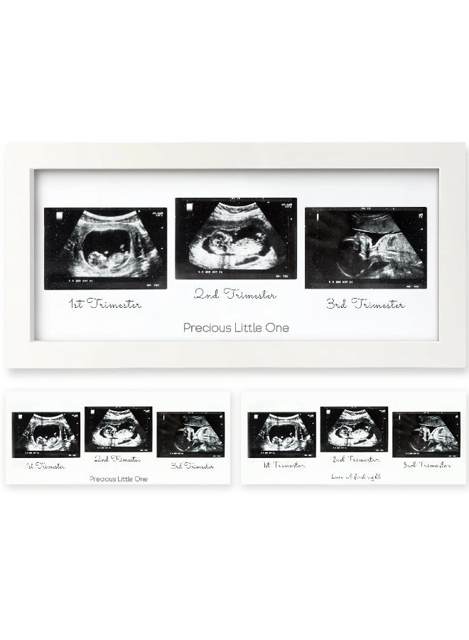 KeaBabies Trio Baby Sonogram Frame, Ultrasound Keepsake, Alpine White - Image 1