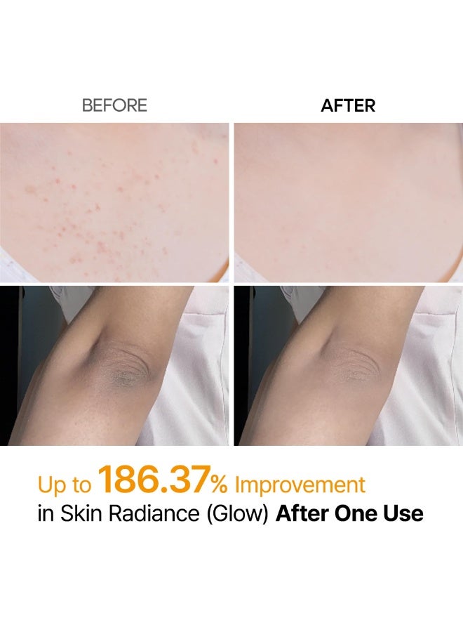 Dr.Melaxin Body Keratin Care Kojic Acid Turmeric Spray Gently Exfoliating Peeling Solution Korean Skincare All Skin Types 200ml - Image 3