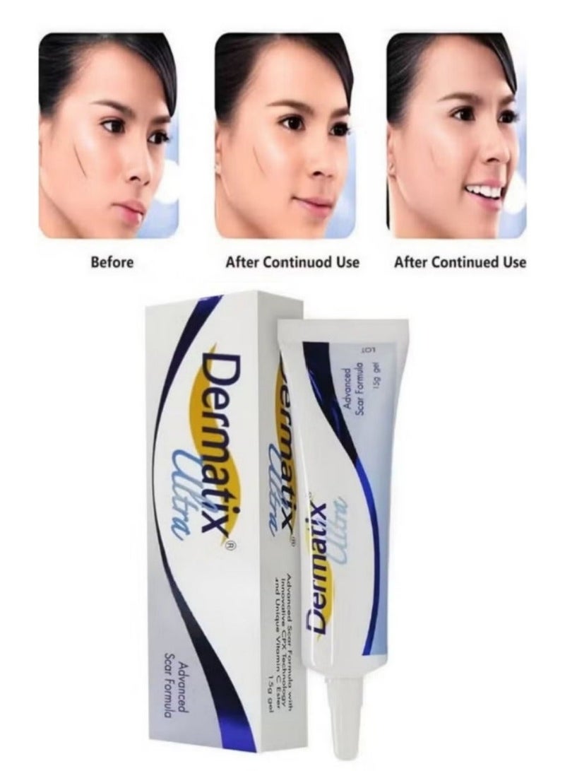 Dermatix Premium Silicone Scar Gel 15g – Fast-Absorbing Treatment for Keloids, Surgical & Hypertrophic Scars | Sensitive Skin Safe - Image 2