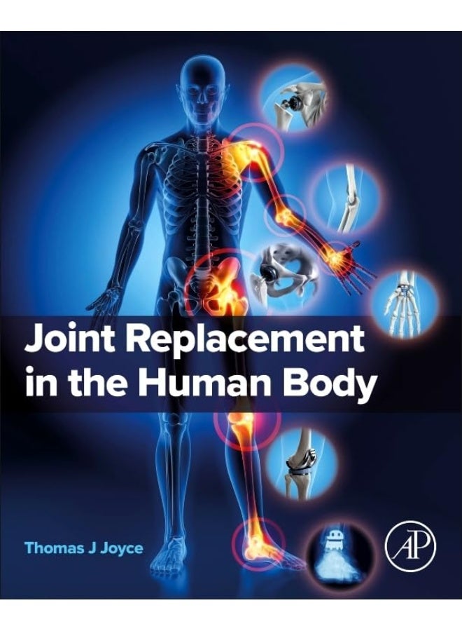 Joint Replacement in the Human Body