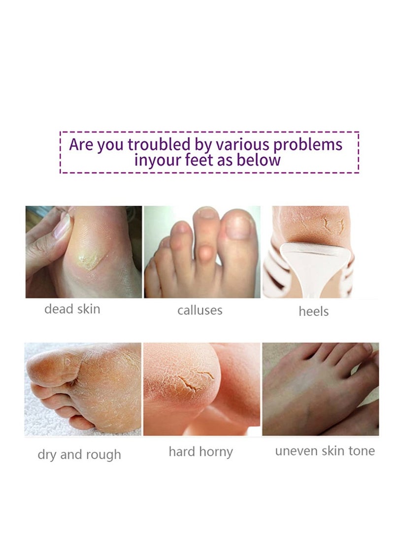 AIQIUSHA Foot Peel Mask 5 Pack,Lavender Exfoliating Foot Masks, Soft Smooth Touch Natural Exfoliator for Dry Dead Skin, Callus, Repair Rough Heels,Gifts for Women Mom and Men  - Image 4