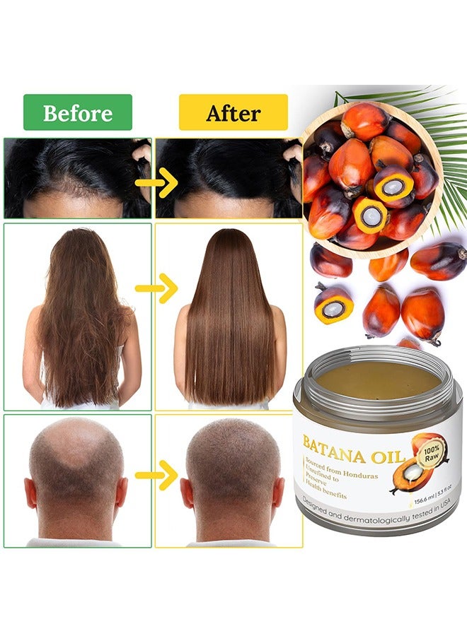 بابوسو Raw Batana Oil - 100% Natural And Organic Hair Growth Oil Solution For Men And Women, Raw, Unrefined, Enhances Thickness, Prevents Hair Loss - Image 5