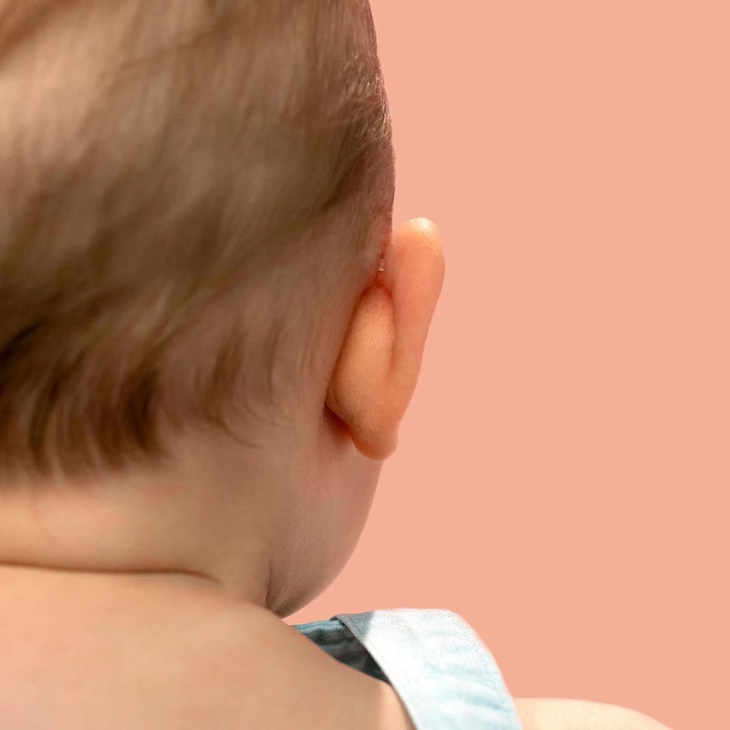 Otostick Baby  8 Count Discreet Protruding Ear Corrector for Babies with Baby Cap  Ear Support Baby Items for Correction of Large Ears from 3 Months - Image 5